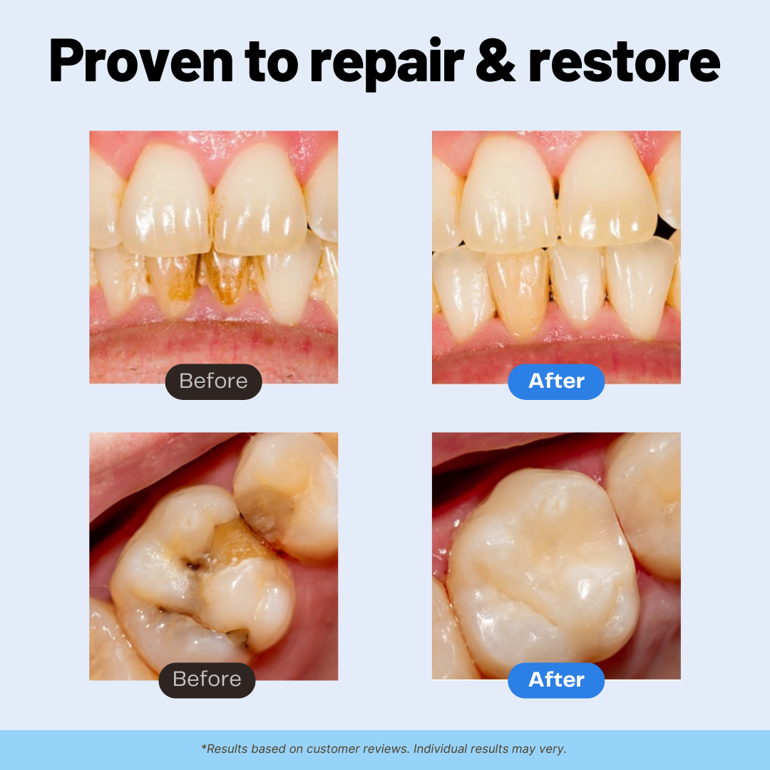 Last Day 50% OFF🔥Remineralizing Repair+ Toothpaste