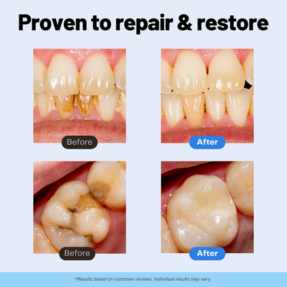 Last Day 50% OFF🔥Remineralizing Repair+ Toothpaste